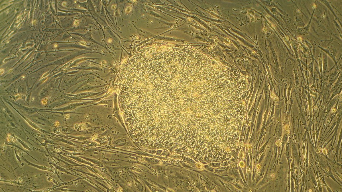Phase-contrast micrograph of a pluripotent stem-cell colony — source cells for genitourinary tissue engineering and kidney organoids, Panacea Bio Chem, Bogdan Dicoias